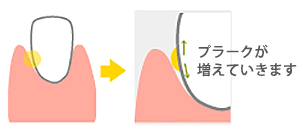 ポケットの中